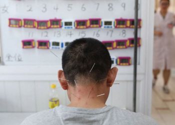 Les acupuncteurs réagissent vivement aux critiques de Vandenbroucke sur leur pratique – RTBF Actus