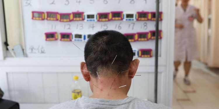 Les acupuncteurs réagissent vivement aux critiques de Vandenbroucke sur leur pratique – RTBF Actus