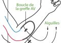 découvrez les symptômes, les risques et les principaux traitements de la phlébite pour mieux comprendre cette maladie veineuse et agir rapidement.